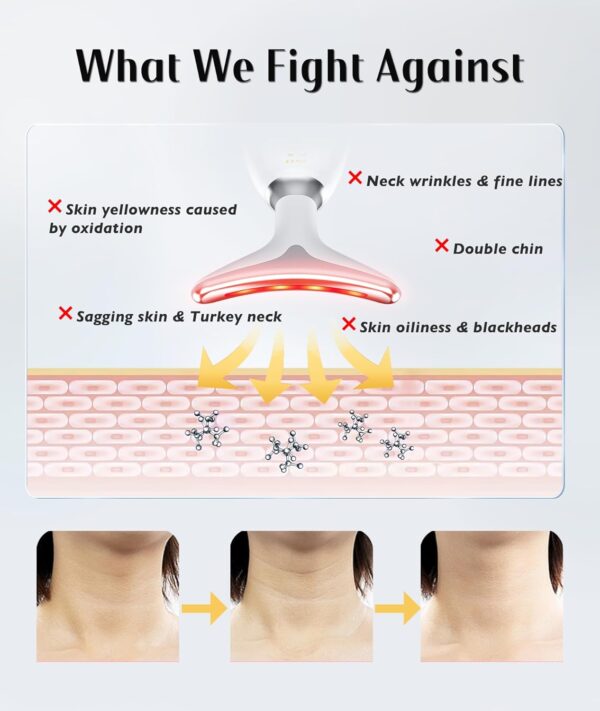 Red-Light-Therapy-for-Face and Neck, Red Light Therapy Wand - Image 2
